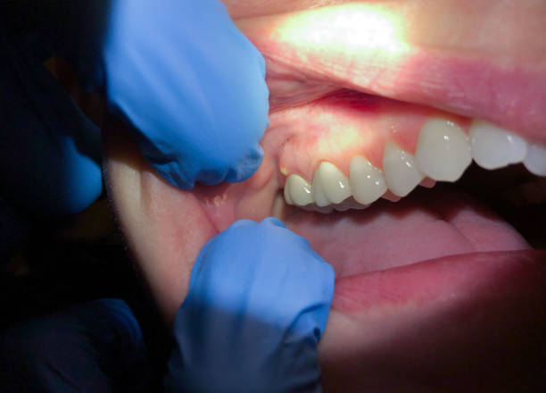 Best Walk-In Emergency Dentist in Mars Hill, NC